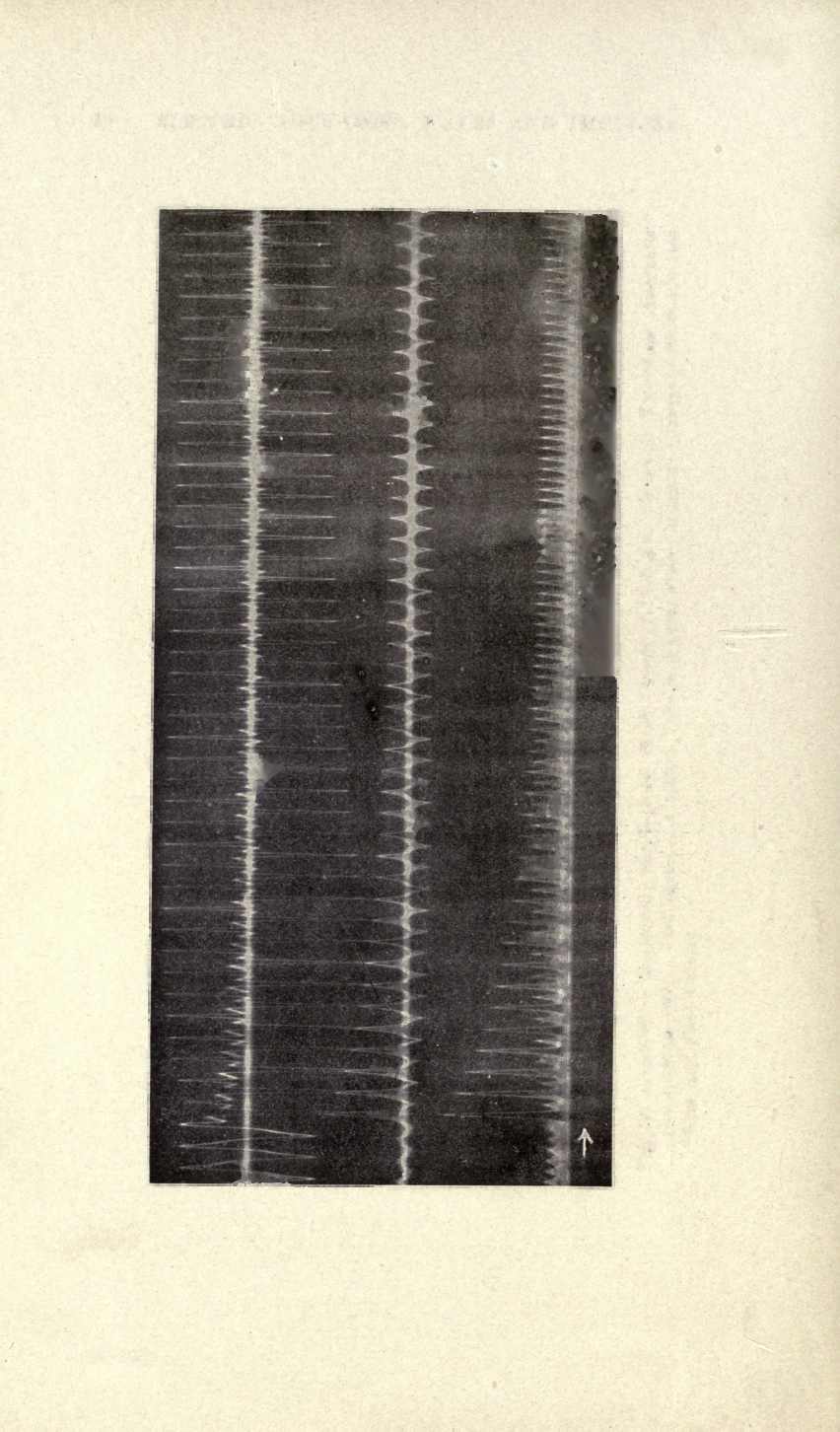 Extracted scan image candidate from page 64